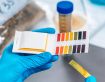 The benefits of urine pH testing go beyond monitoring DCAD