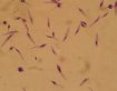Leishmania major